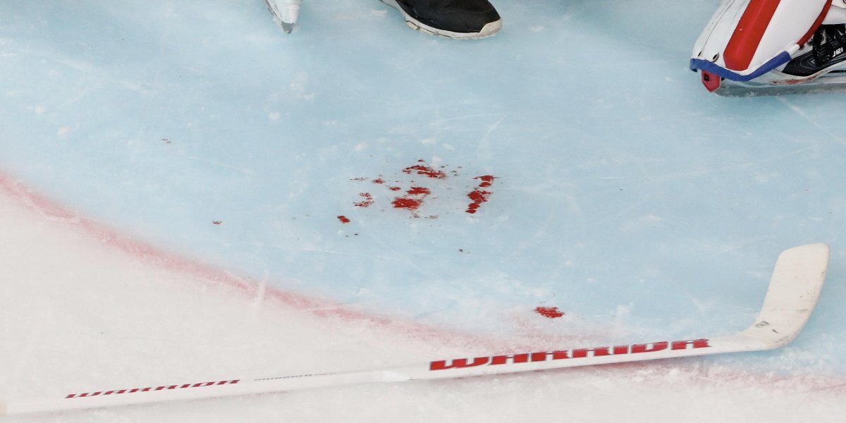 Хоккеисту клуба КХЛ на раскатке перед матчем разрезало ногу коньком