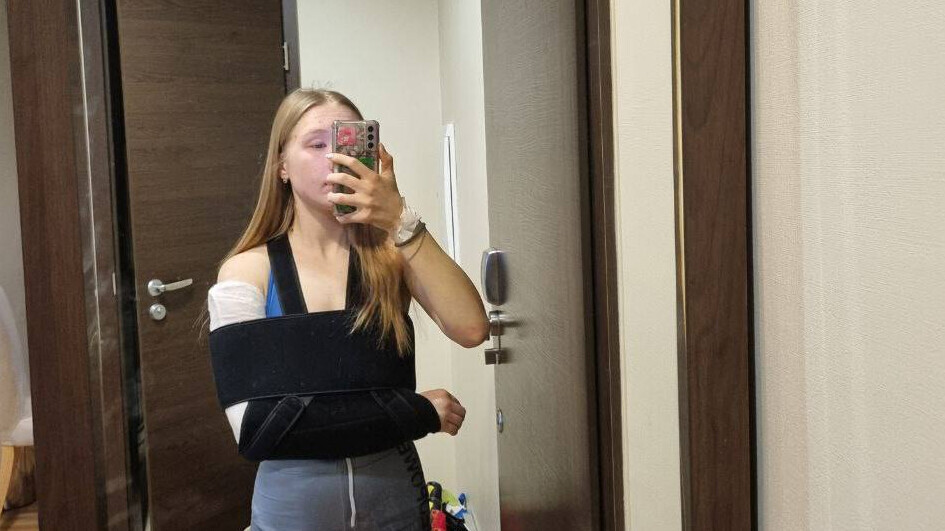 Шестнадцатилетняя лыжница рассказала о переломах после падения в гонке на Спартакиаде учащихся