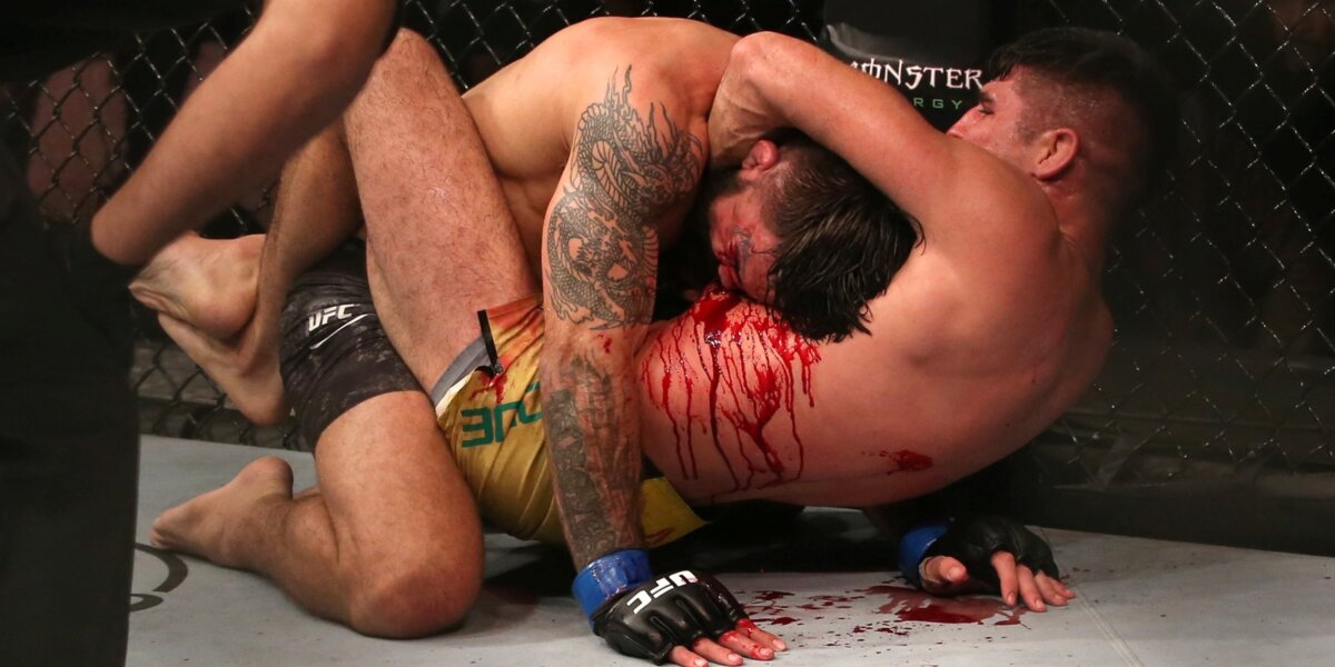 Такого перелома носа вы еще не видели. UFC в Уругвае  — первое поражение российского бойца и победа Шевченко