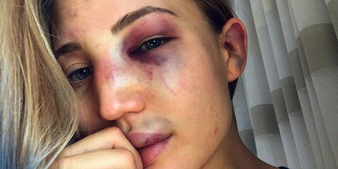 Анастасия Янькова фотографирует себя после боя
