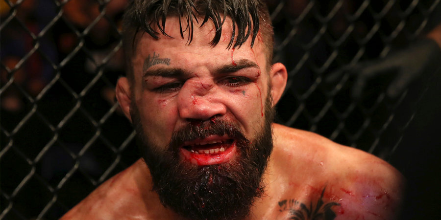 «Одна из худших травм. Да здравствует насилие!» Соперник Нурмагомедова отреагировал на жуткую травму носа бойца UFC
