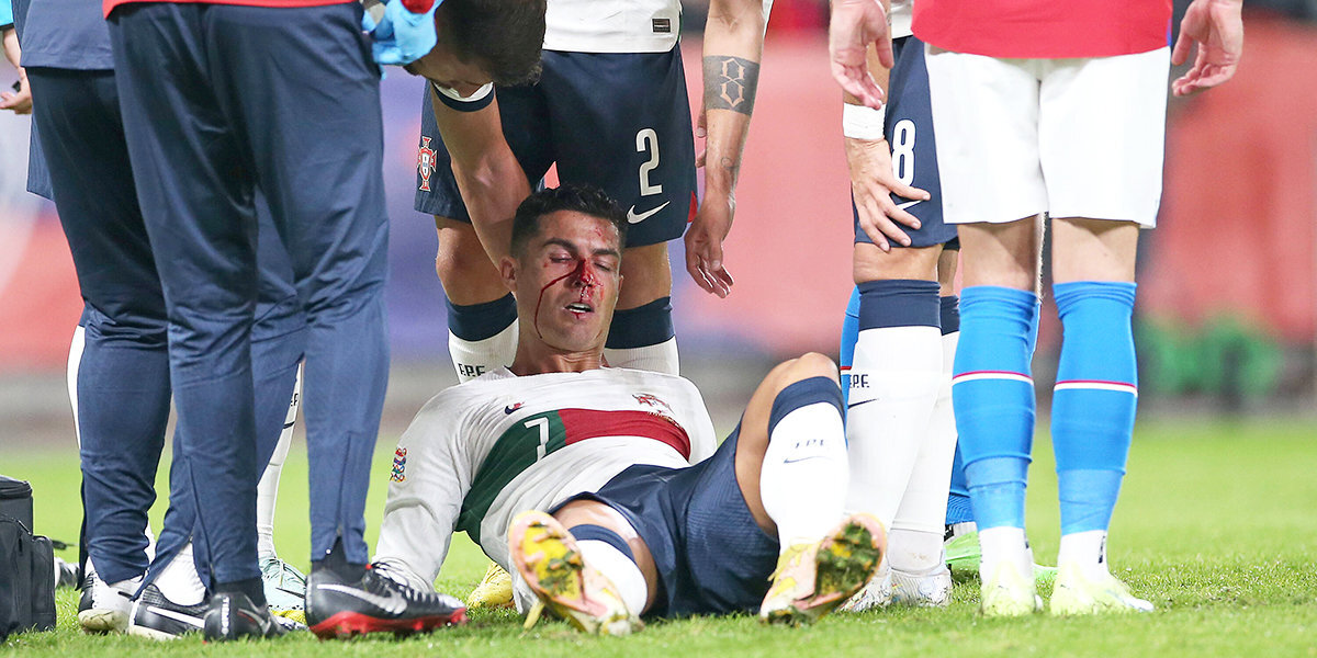 Роналду разбили нос в матче Лиги наций со сборной Чехии