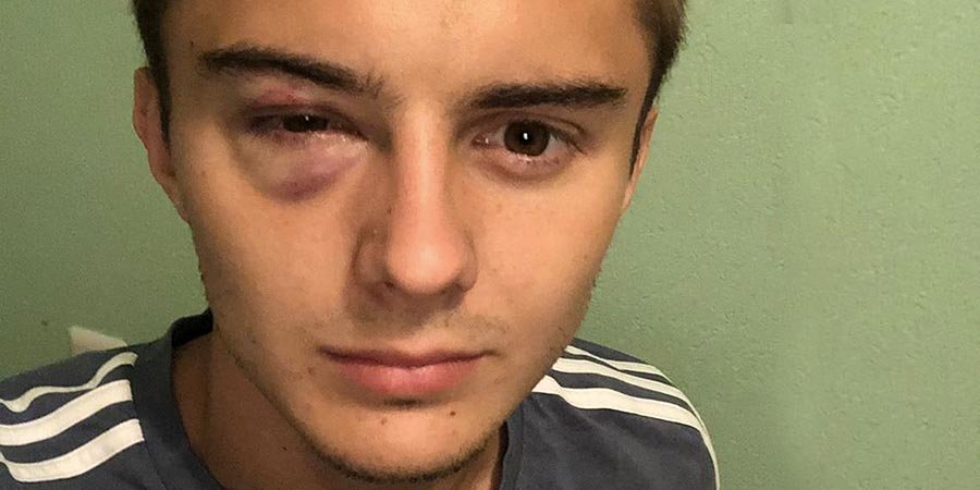 Александр Зуев — о травме в матче с «Уфой»: «Арбитр сказал: «Хватит валяться»