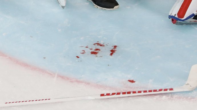 В Канаде бывший хоккеист юниорской лиги подал иск на $15 млн. Он утверждает, что в команде его избивали куском мыла в полотенце