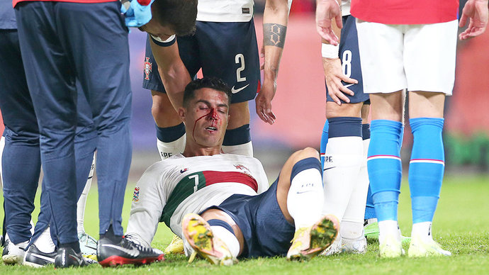 Роналду разбили нос во время матча Лиги наций с чехами, форвард смог продолжить игру