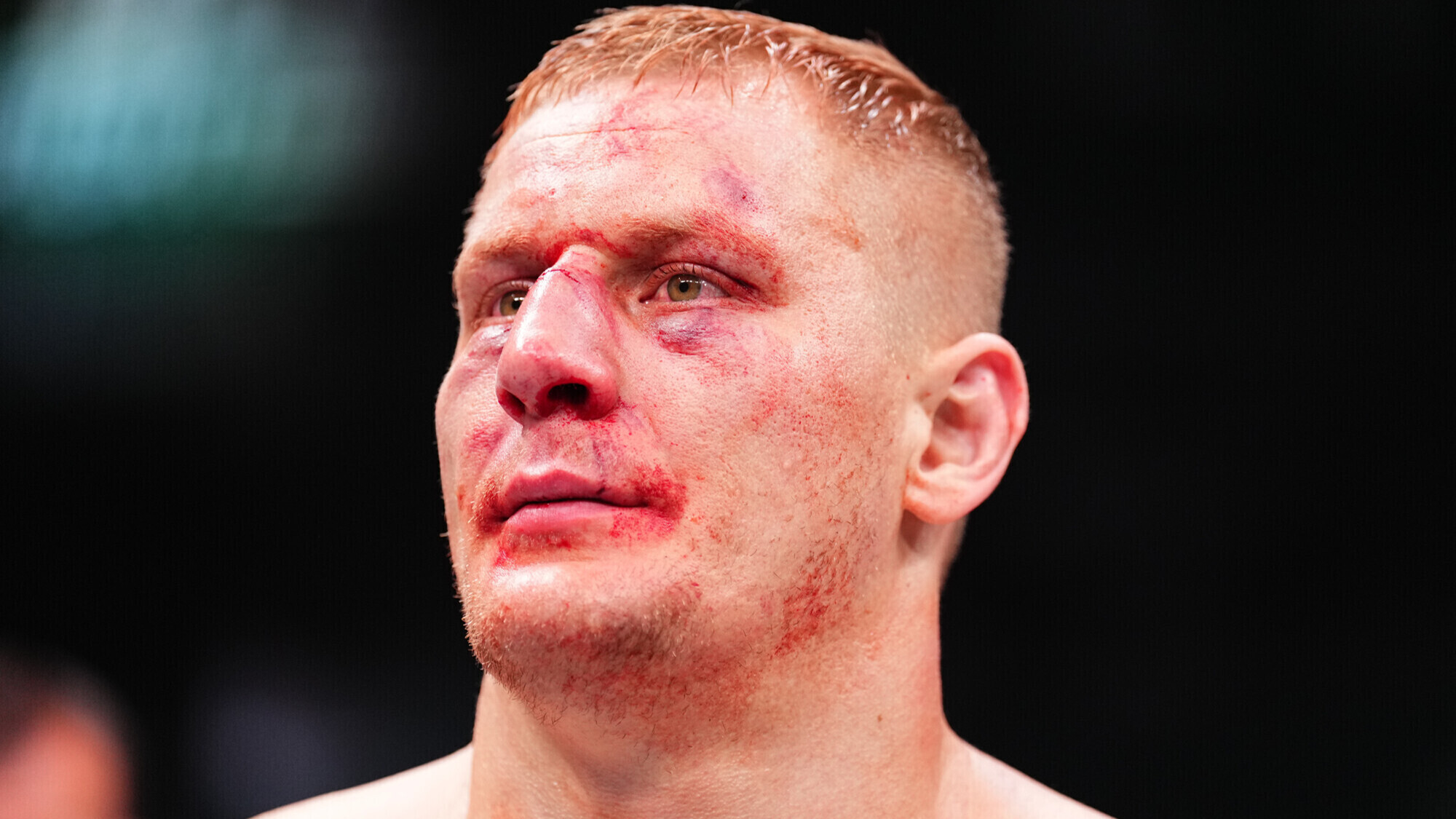 Сергей Павлович получил перелом носа в бою с Александром Волковым Сергей Павлович получил перелом носа в бою с Александром Волковым