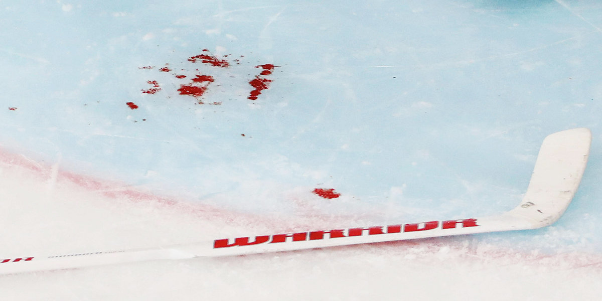 Комментатору НХЛ разбили голову шайбой во время матча. Болельщики ахали от страха